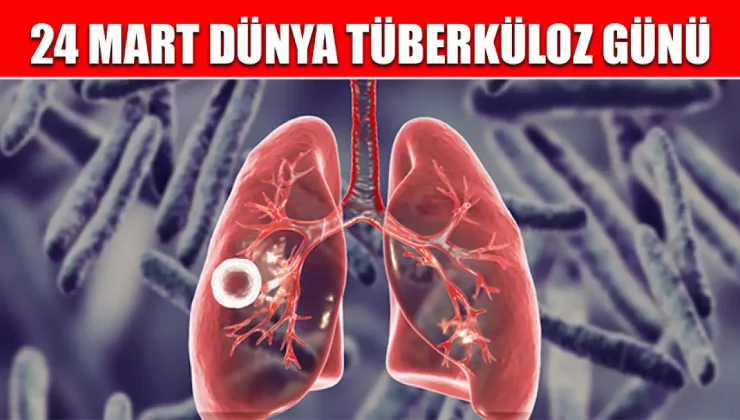 Sağlık Bakanlığı’ndan Dünya Tüberküloz Günü açıklaması