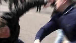 Lefkoşa’da Apartman Koridorunda Kavga: Bir Kişinin Burun Kemiği Kırıldı