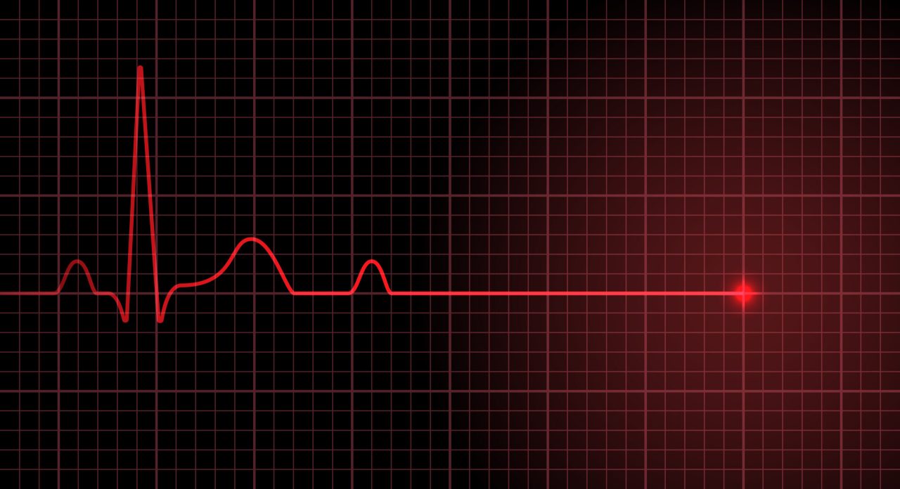 21 yaşındaki Buse Kara’nın ölüm sebebi “akciğer enfeksiyonu ve pulmoner emboli”